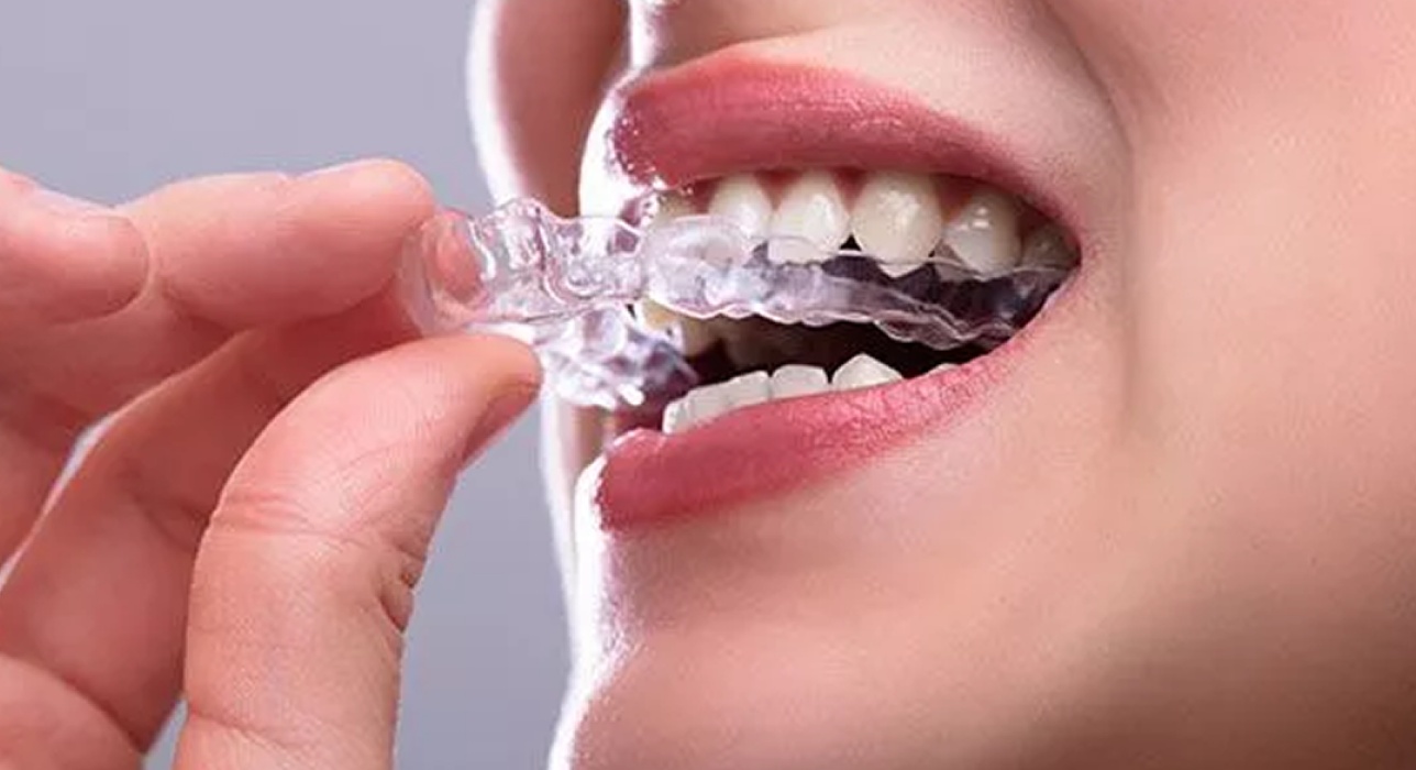 Custom Night Guards for Teeth Grinding in Martinsville, VA